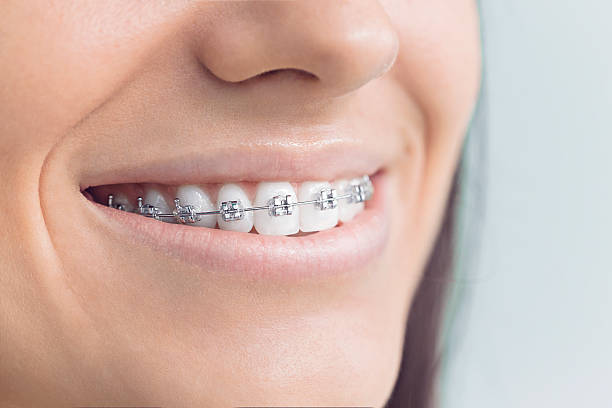 Best Wisdom Tooth Removal  in Old Jamestown, MO